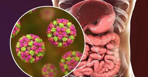 Норовирус в США: вспышка желудочно-кишечной инфекции