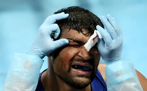 Boxing doctor examining eye injury