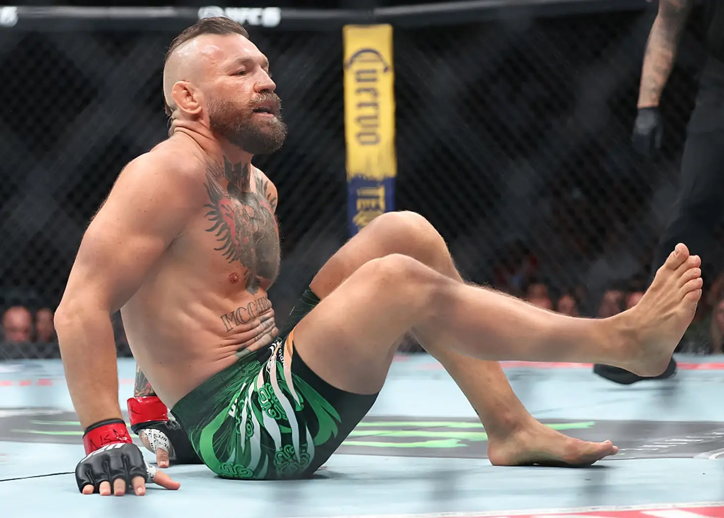 Conor McGregor social media post injury